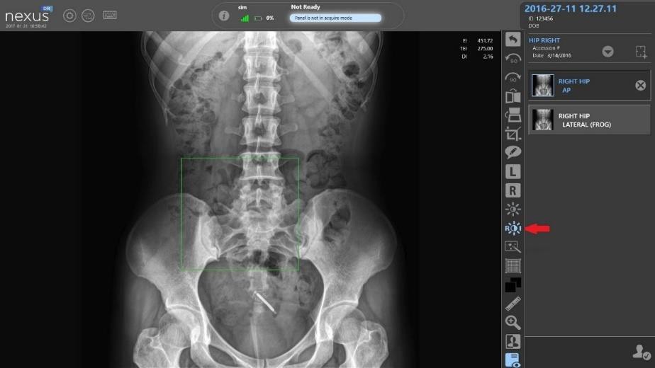 Чёткий рентгеновский снимок